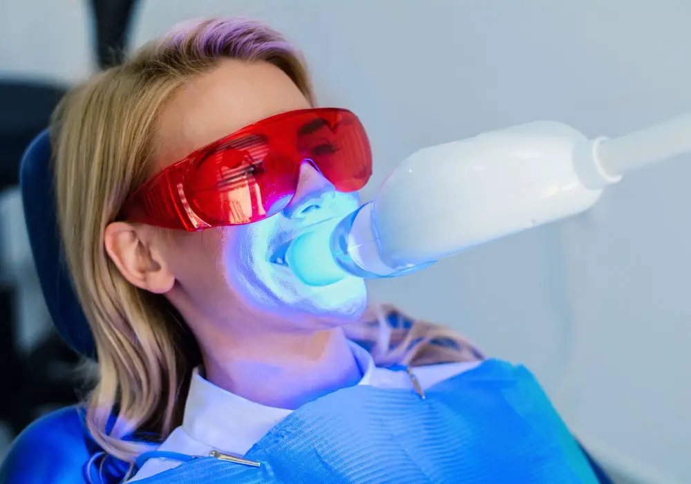 the most common professional whitening options