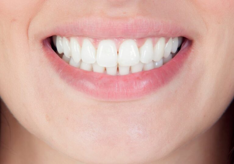 Are Human Teeth Strong? A Closer Look at Tooth Strength and Durability