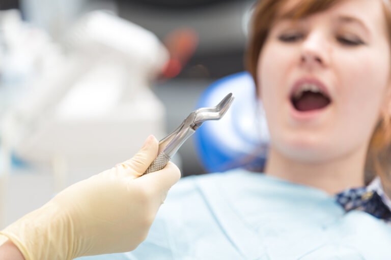 Are Teeth Hard to Remove? Tips for a Smooth Extraction Process