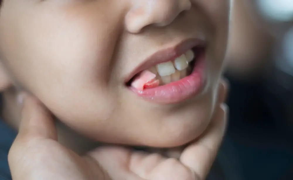 Using Cotton Instead of Gauze After Tooth Extraction What You Need to Know