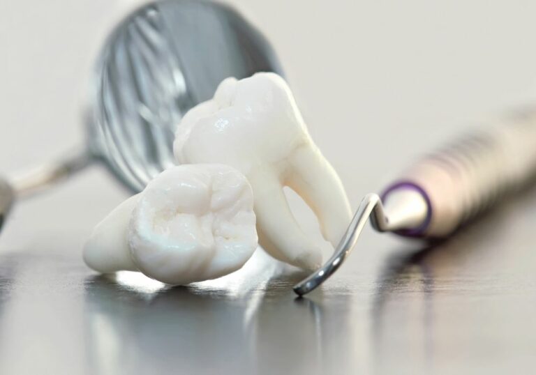 Can Wisdom Teeth Pain Affect Other Teeth? Exploring the Connection