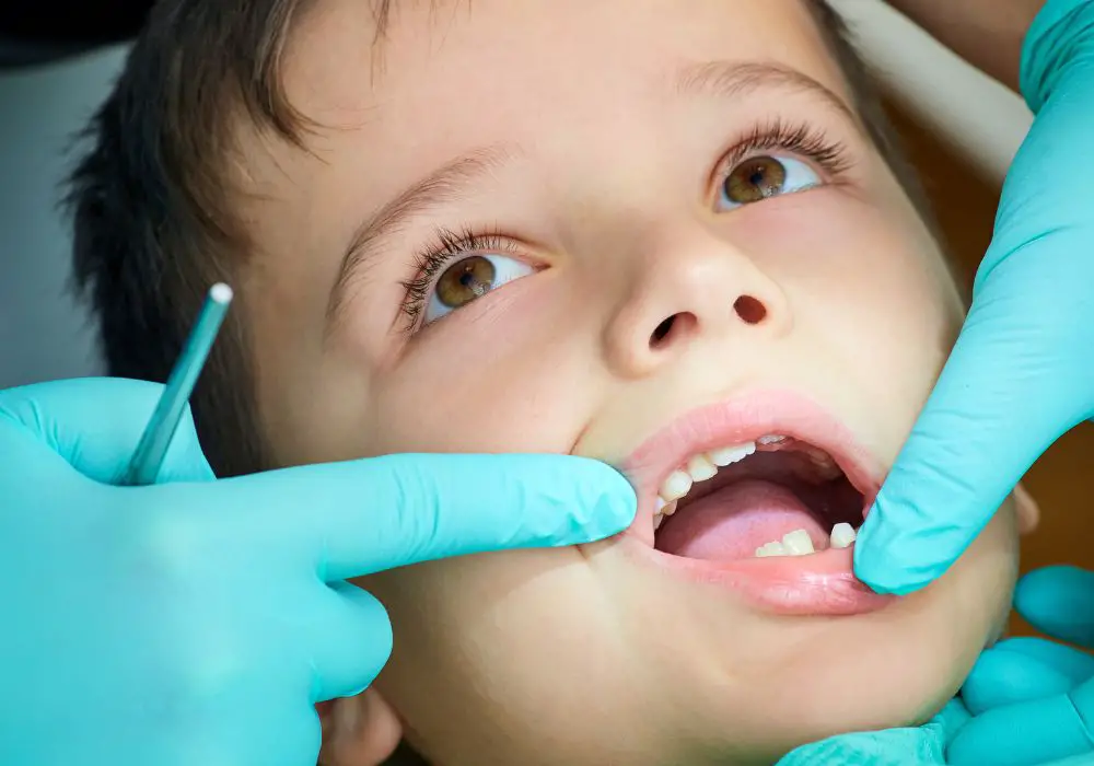 Caring for Baby Teeth