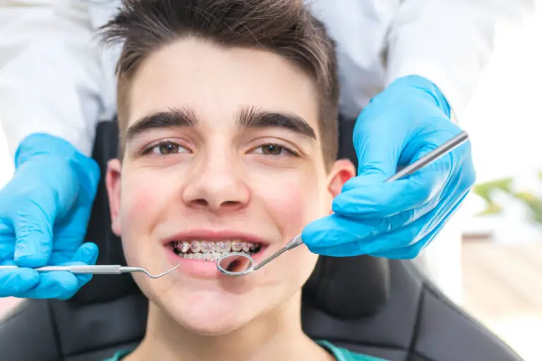 Do Brackets Move Teeth? A Comprehensive Guide to Orthodontic Treatment