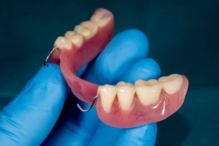 Do Partials Damage Teeth? The Truth About Wearing Partial Dentures
