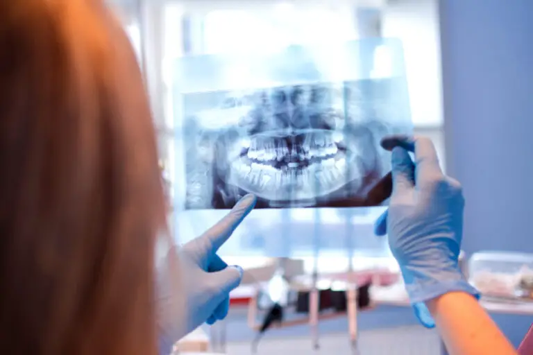 Do Teeth Go Through Bone? Understanding Tooth Anatomy and Structure