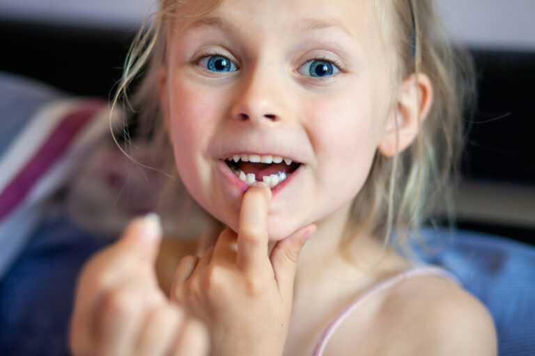 Do All Milk Teeth Go Away? Everything You Need to Know