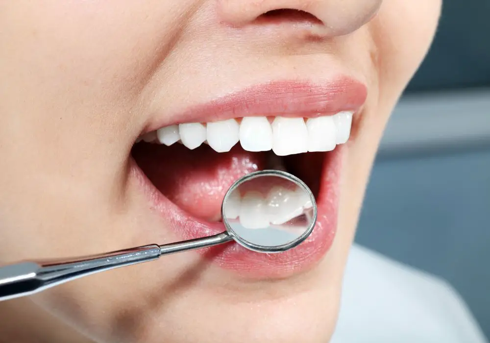 Effect of Hydrogen Peroxide on Teeth