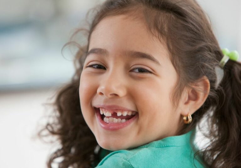 Fixing the Gap Between Teeth Naturally: What You Need to Know