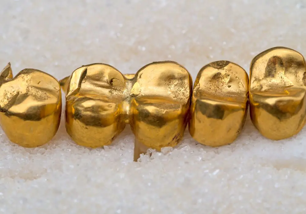 History of Gold Teeth