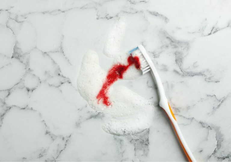 How to Stop Gums from Bleeding When Brushing: Tips and Tricks