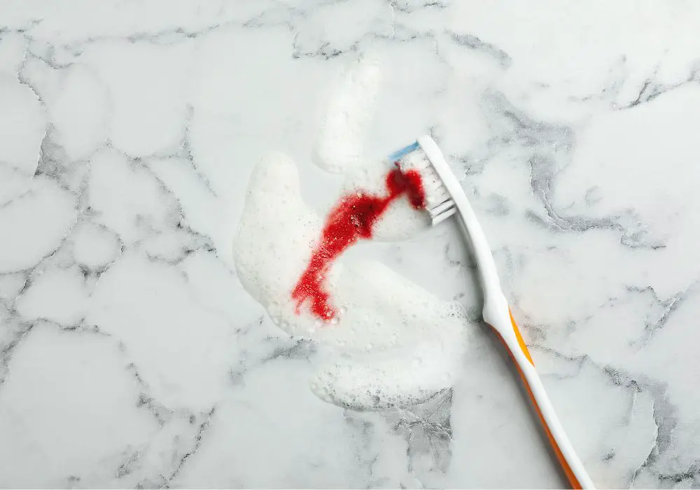 How to Stop Gums from Bleeding When Brushing Tips and Tricks