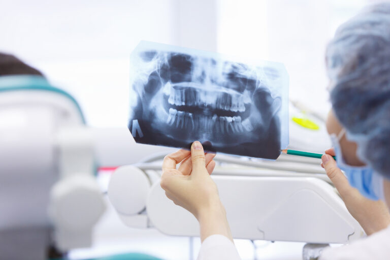 Using Teeth Radiographs to Determine Age