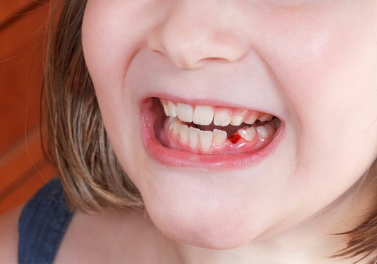 How Many Is a Baby Tooth? Your Guide to Understanding Your Child’s Dental Development