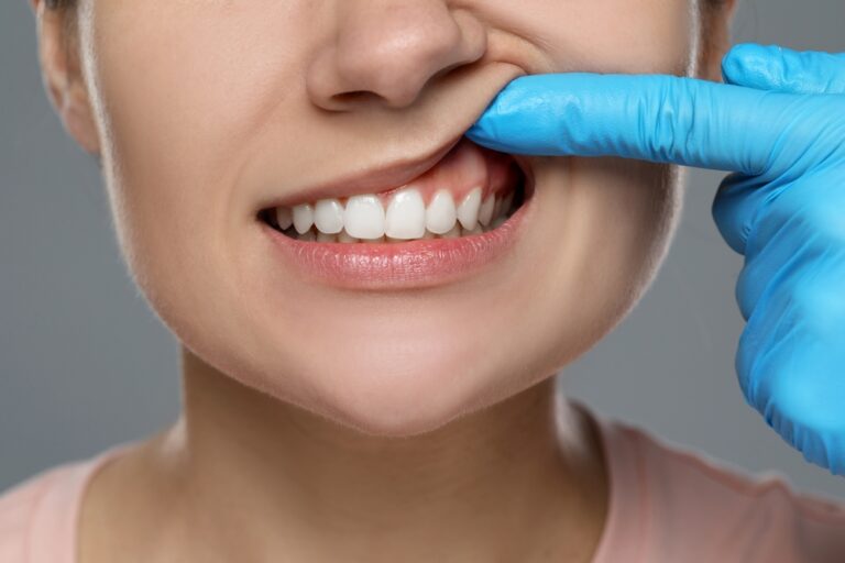 How to Clean Your Gums: Tips and Tricks for a Healthy Smile