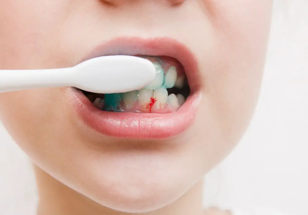 Importance of Regular Dental Check-Ups