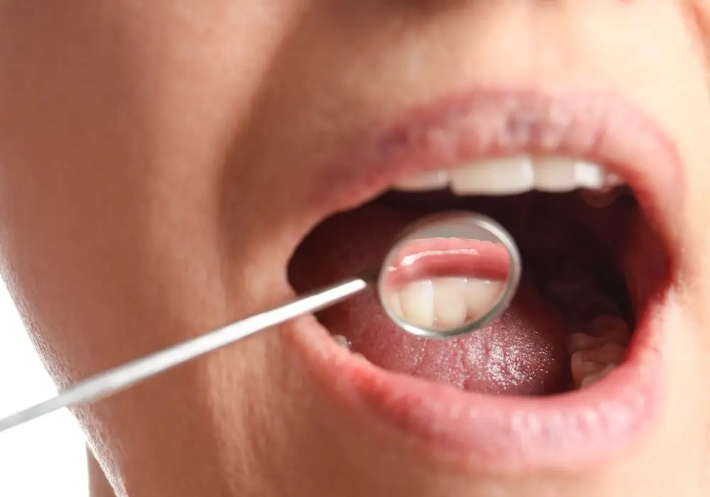 Maintaining Gum Health Post Cleaning