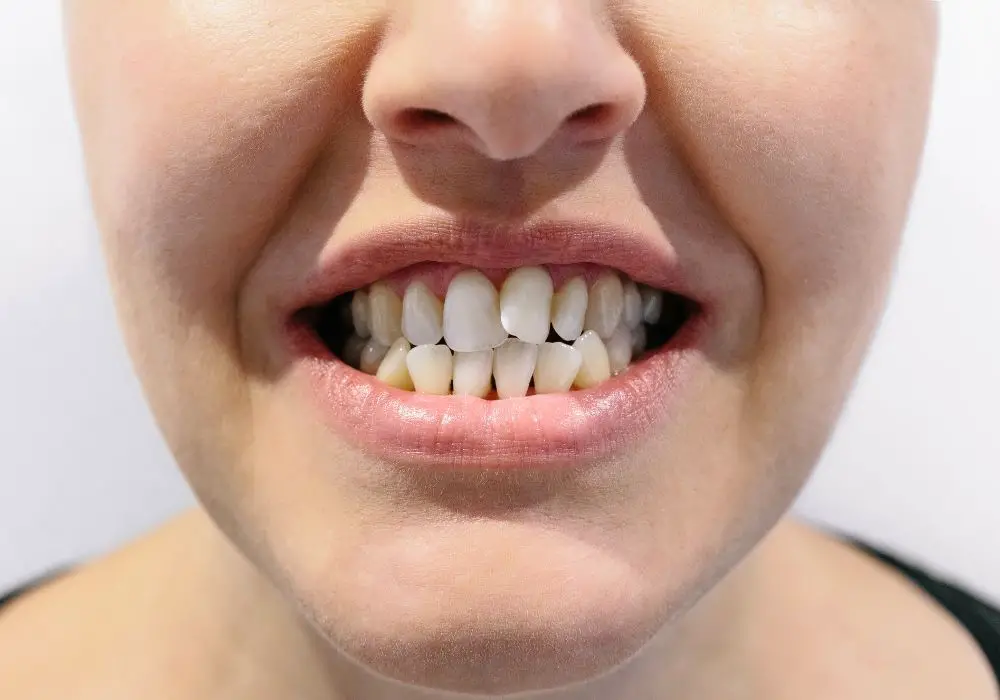 Modern Views on Tooth on Tooth