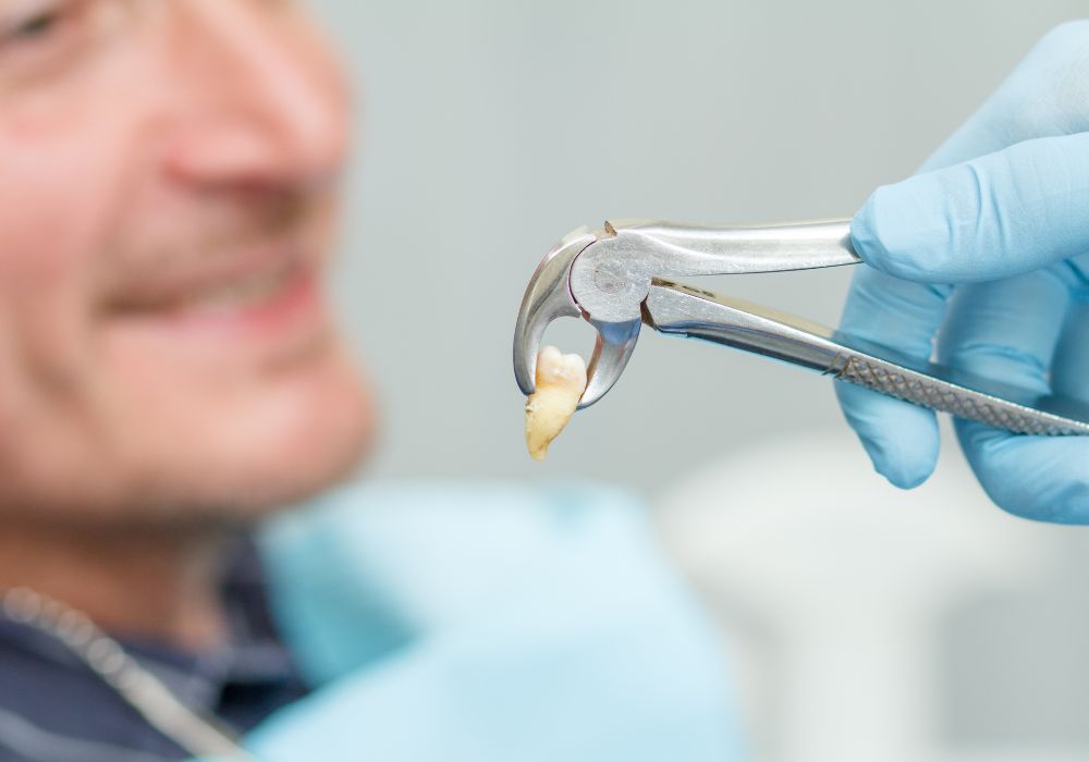 Procedure of Wisdom Teeth Removal