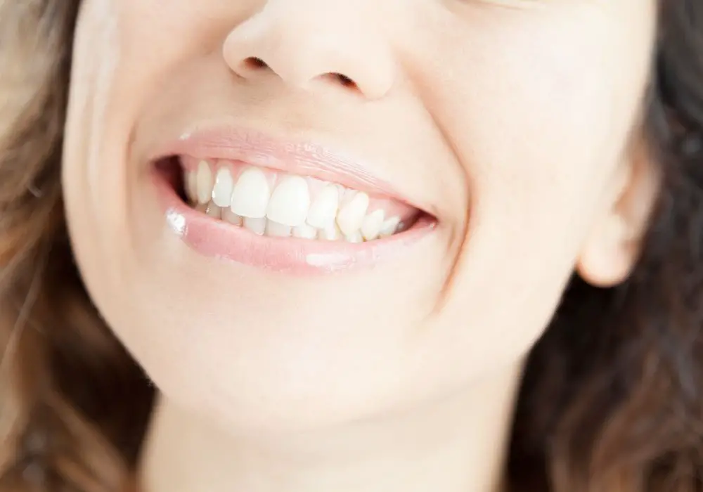 Professional Dental Procedures for Teeth Reshaping