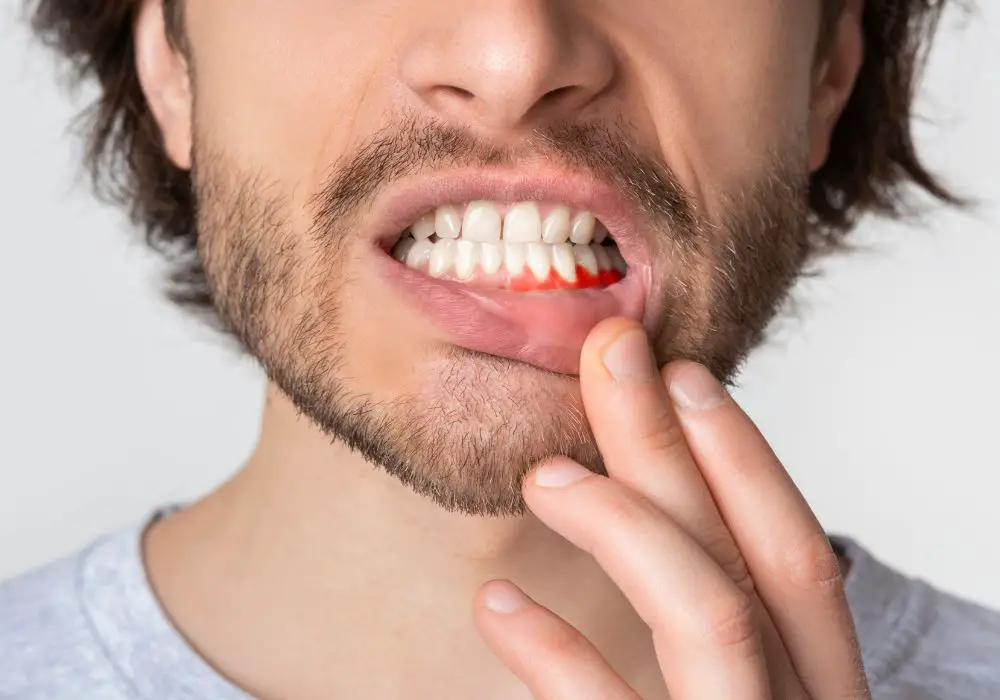 Symptoms of Tooth Erosion