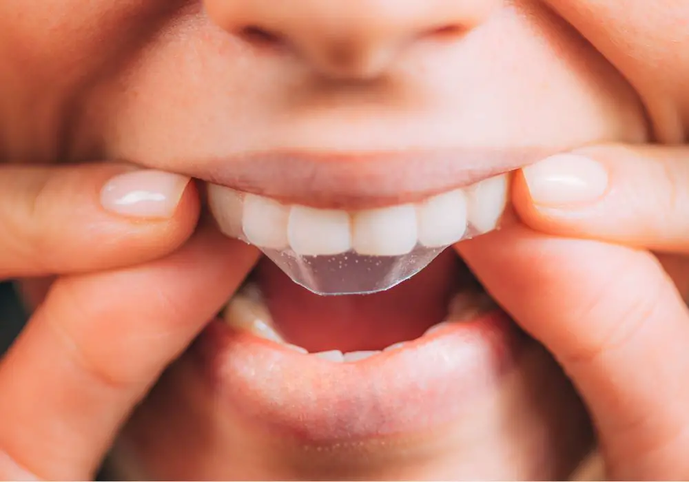 Tips for Effective Teeth Whitening