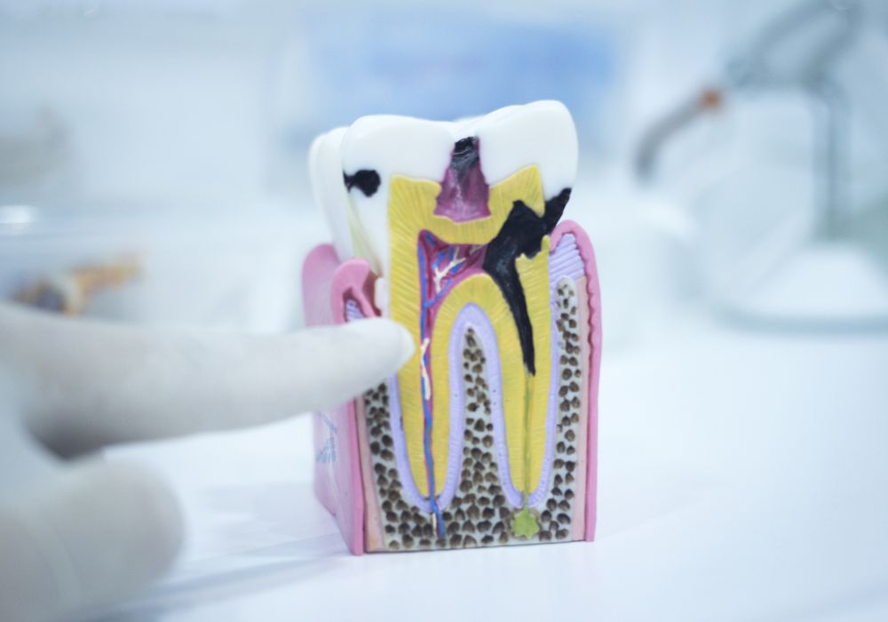 Tooth Anatomy Model