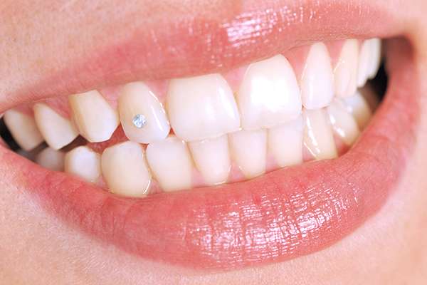 Tooth Gems and Oral Hygiene