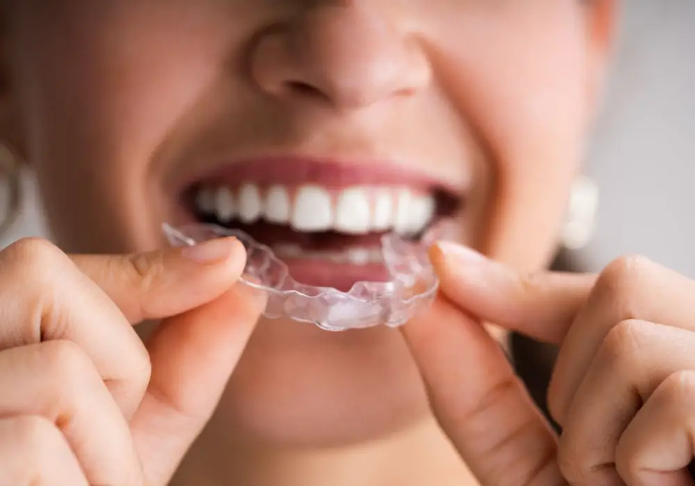 Understanding Dentek Dental Guards