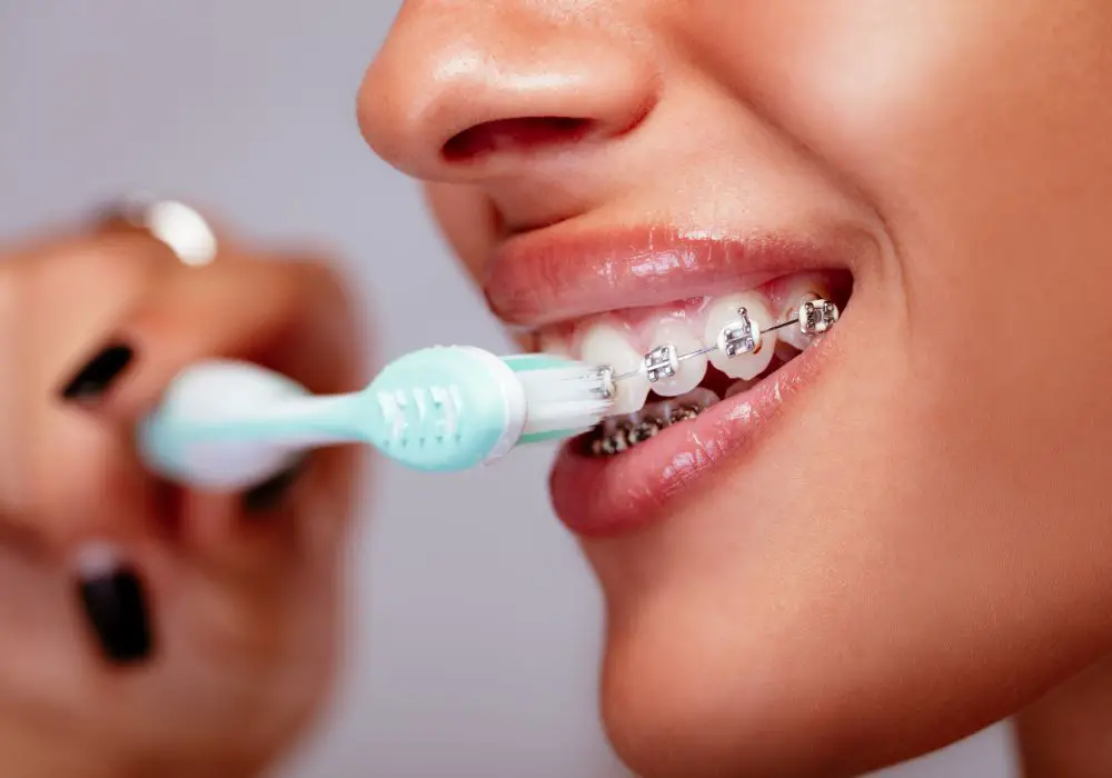 Understanding Orthodontics