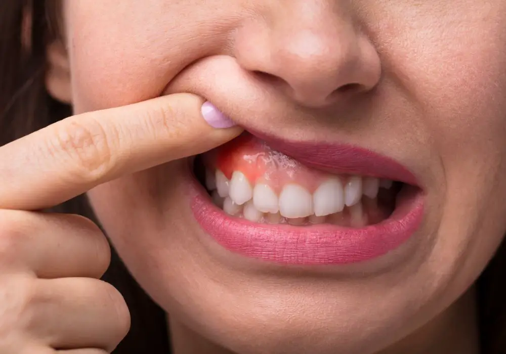 Understanding Swollen Teeth