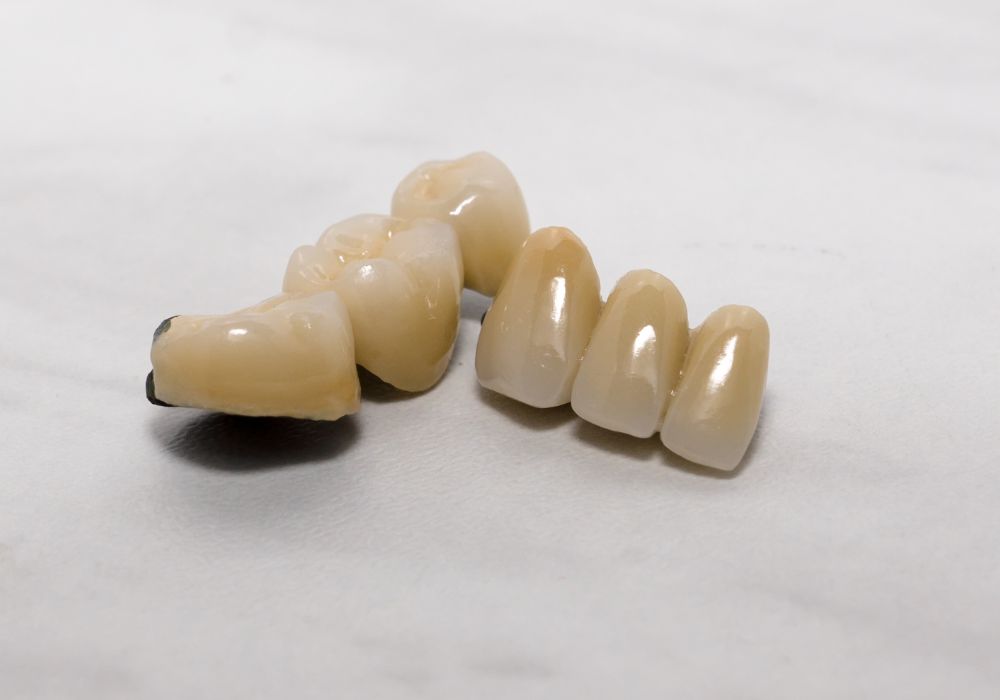 Understanding Teeth Caps