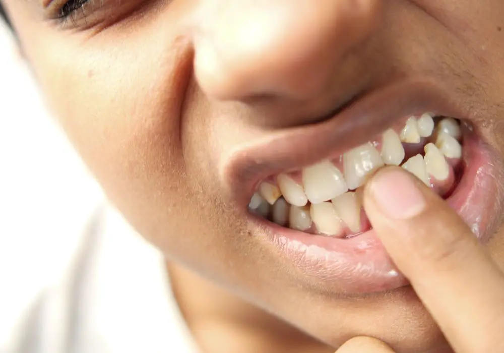 Understanding Teeth Development