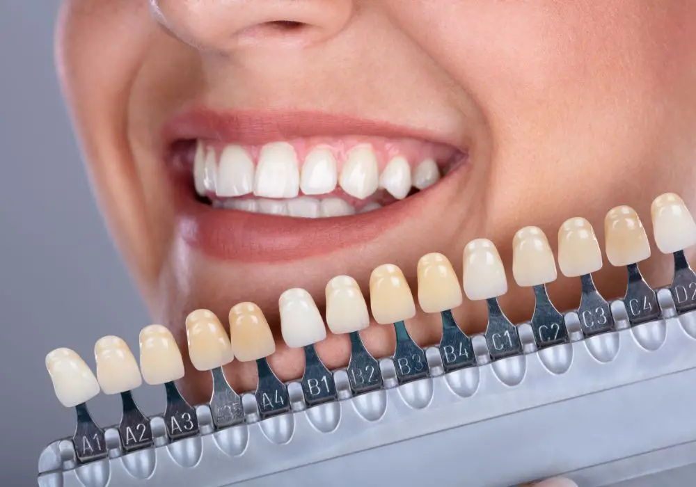 Understanding Teeth Shades
