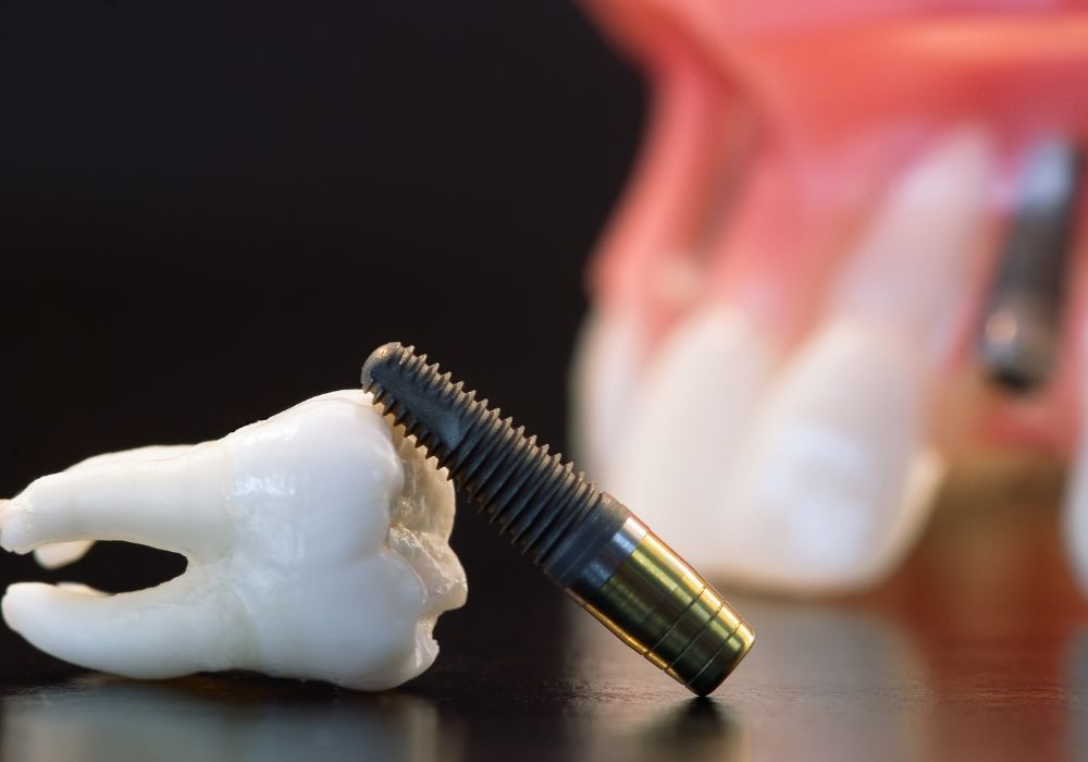 Understanding Tooth Anatomy