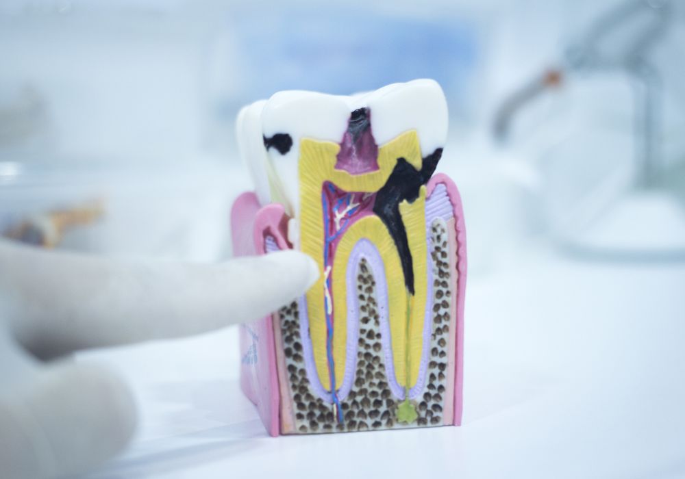 Understanding Tooth Anatomy