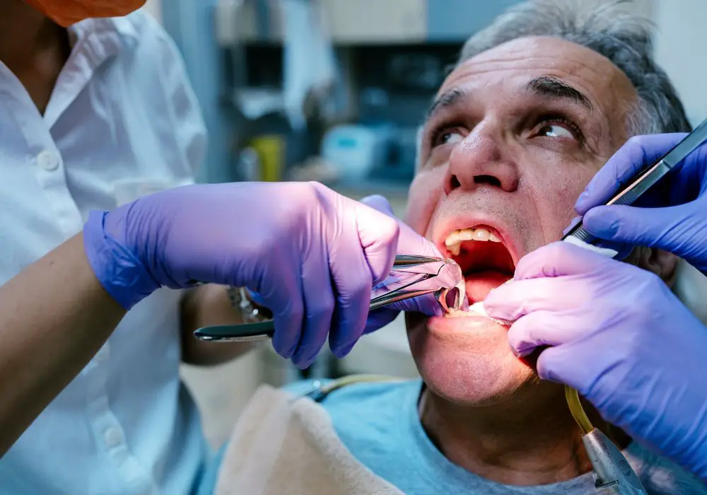 Understanding Tooth Extraction