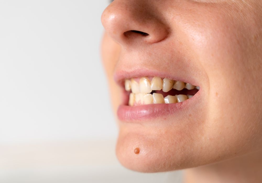 Understanding Tooth Movement