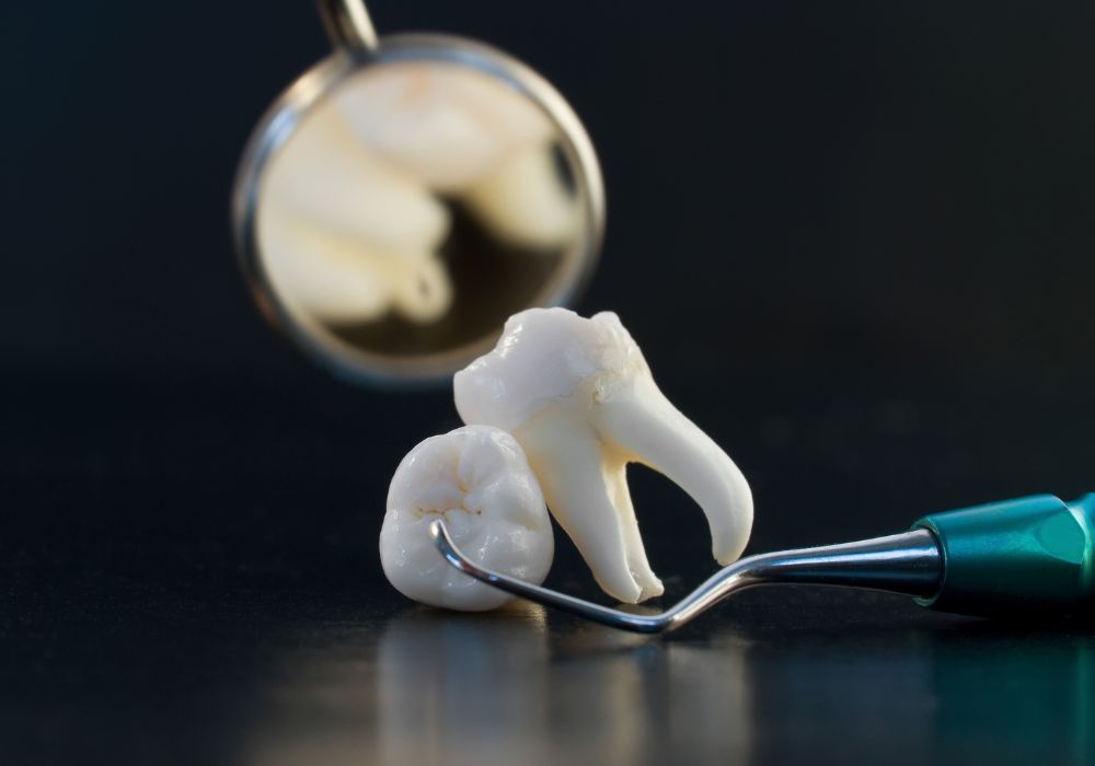 Understanding Wisdom Teeth Growth