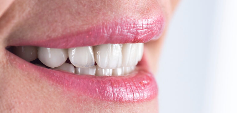 What Color Are A2 Teeth? A Friendly Guide to Understanding Tooth Shades