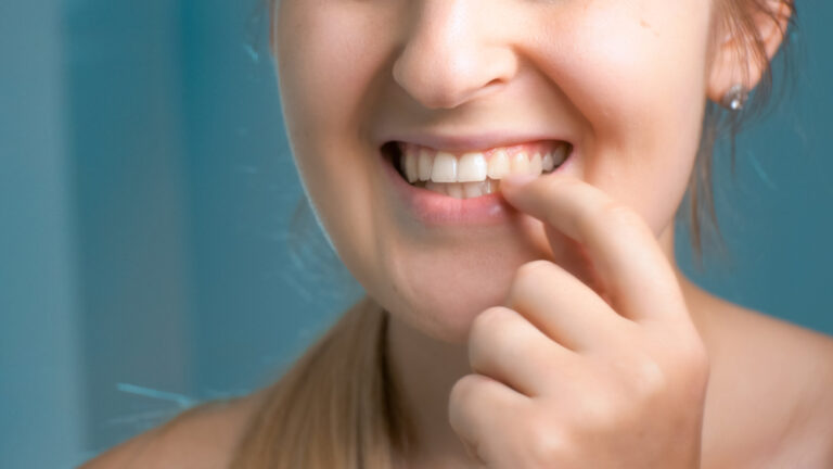 What are 4 Types of Teeth? A Quick Guide to Understanding Your Pearly Whites