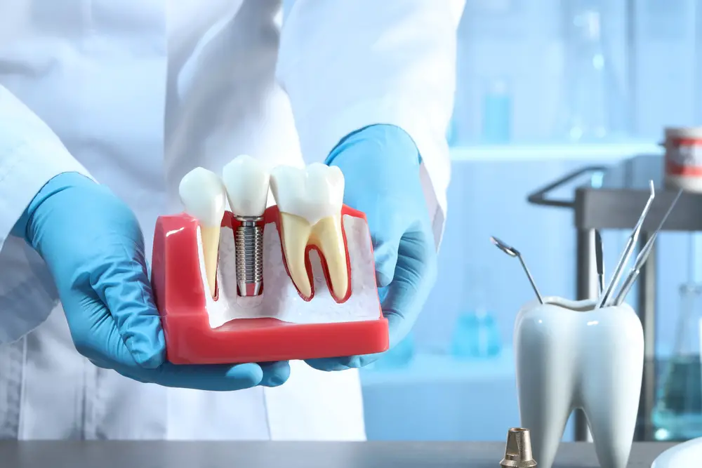 What is Teeth in an Hour? A Quick Guide to SameDay Dental Implants