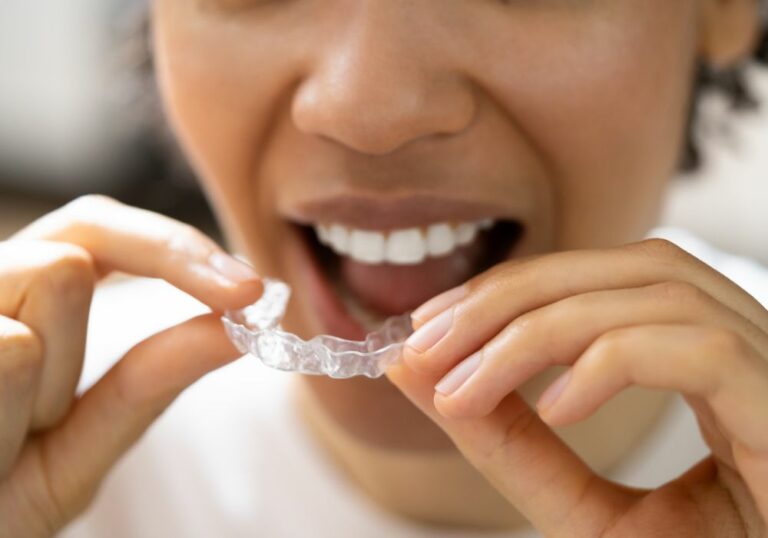 Using DenTek Dental Guard on Lower Teeth: What You Need to Know