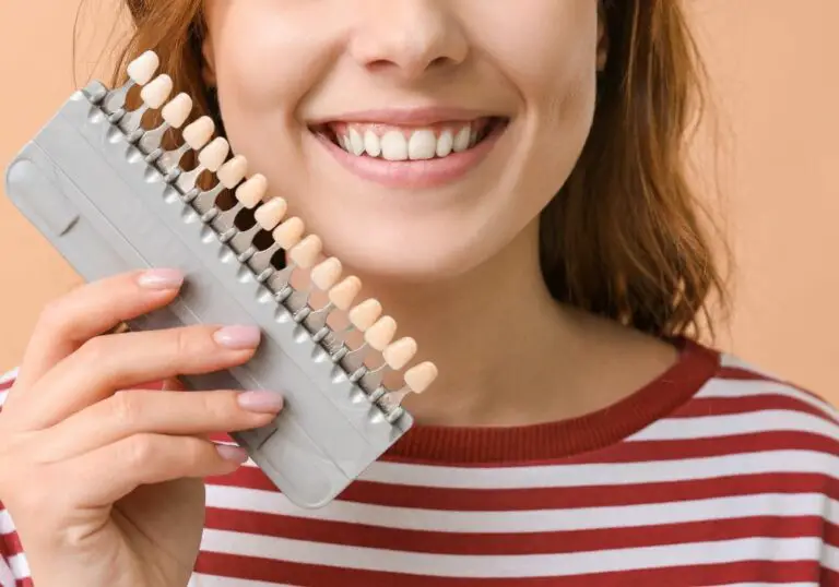 Ultimate Guide to Dental Veneer Care: Tips for Longevity