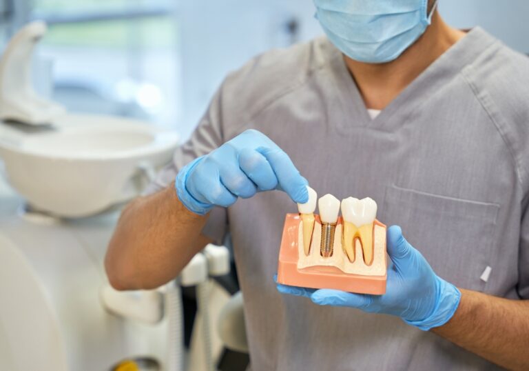 The Importance of Choosing a Qualified Implant Dentist