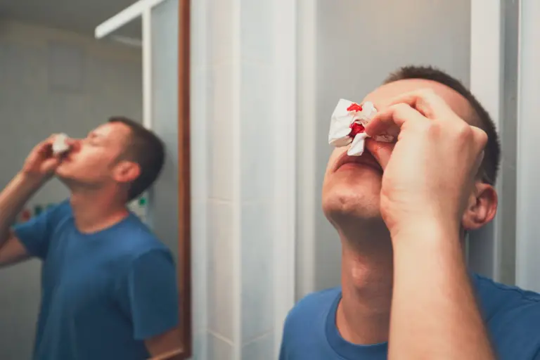 Nosebleeds: Causes, Symptoms, and Treatments